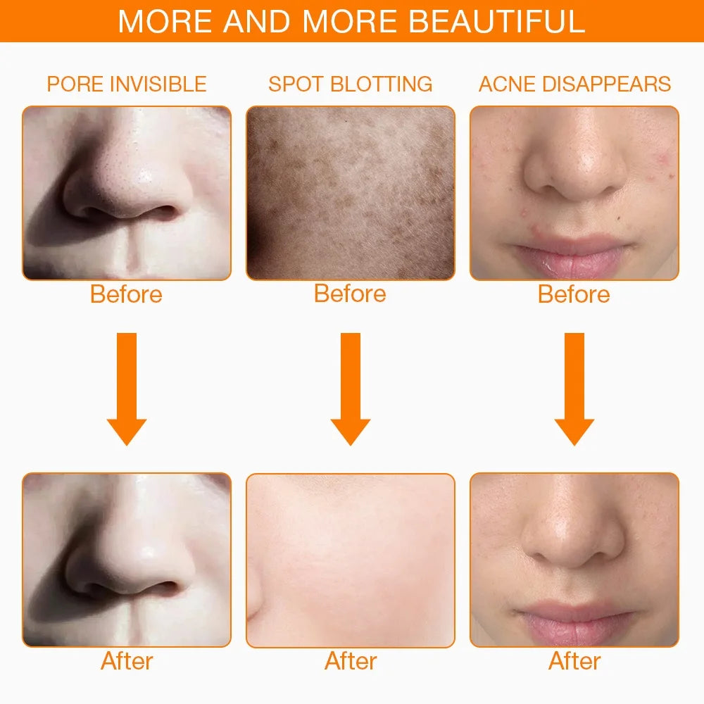 LumaGlow LED Mask Skin Rejuvenation