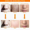 LumaGlow LED Mask Skin Rejuvenation