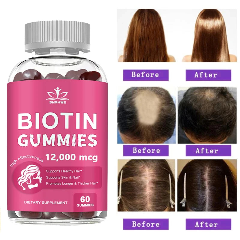Collagen Gummies